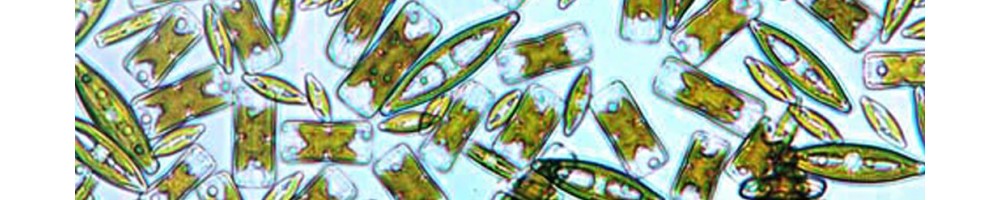 Etudes aquatiques : matériels de recherche : filets aubé, surber, diatomées...